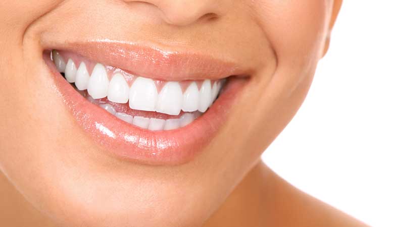 Clinic Kristiina Smiling System -hampaidenvalkaisu 59€ | Offerilla