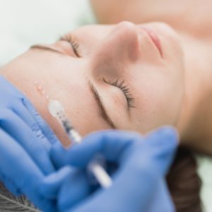 Mesolangat kasvojen alueelle | Säästä 50 % | Helsinki, Ruoholahti