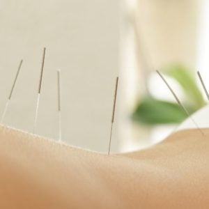 Akupunktio Jingluo Beauty & Wellness